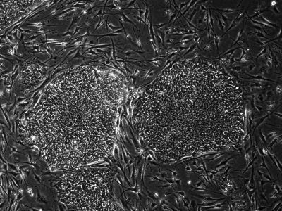 By UCSanDiegoStemCellProgram (Own work) [CC-BY-SA-3.0 (http://creativecommons.org/licenses/by-sa/3.0)], via Wikimedia Commons