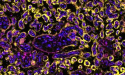 Imagen del tejido de la placenta con TRPV2 marcado, cortesía del equipo de investigación.