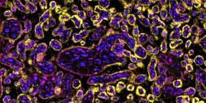 Imagen del tejido de la placenta con TRPV2 marcado, cortesía del equipo de investigación.