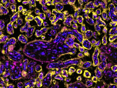 Imagen del tejido de la placenta con TRPV2 marcado, cortesía del equipo de investigación.