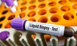 Test para hacer una biopsia líquida en cancer