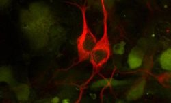 Los investigadores utilizaron CRISPR para rastrear  qué genes actúan como moduladores de la toxicidad de C9ORF72 en células humanas y cultivo primario de neuronas de ratón. Imagen: Neuronas derivadas de células madre embrionarias.  Anirvan Ghosh lab, University of California, San Diego, via CIRM.