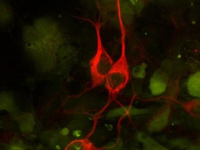 Los investigadores utilizaron CRISPR para rastrear  qué genes actúan como moduladores de la toxicidad de C9ORF72 en células humanas y cultivo primario de neuronas de ratón. Imagen: Neuronas derivadas de células madre embrionarias.  Anirvan Ghosh lab, University of California, San Diego, via CIRM.