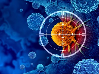 Tres mutaciones asociadas a resistencia en cáncer de próstata abren nuevas vías de tratamiento.