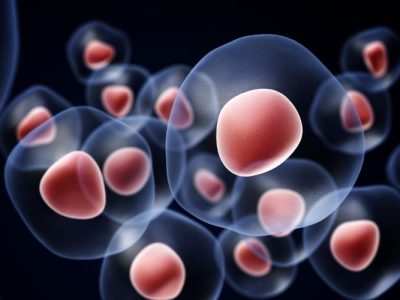 Un estudio ha identificado una diana para el tumor fibroso solitario.