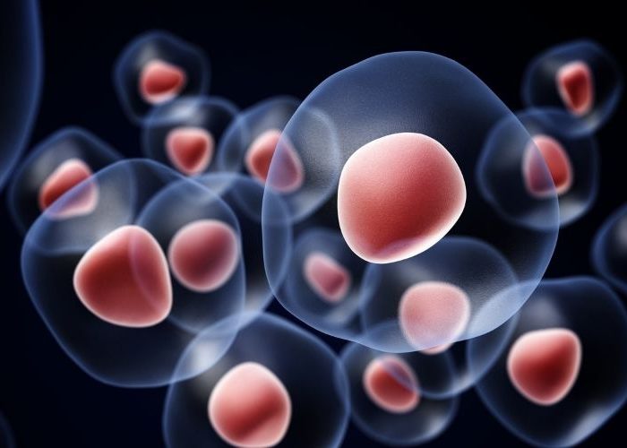 Un estudio ha identificado una diana para el tumor fibroso solitario.