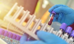 Un estudio plantea que se podría detectar la enfermedad de Lafora en un análisis simple de sangre
