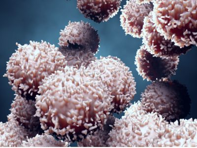 Un nuevo informe sobre terapias avanzadas indica los centros asignados para terapias CAR-T