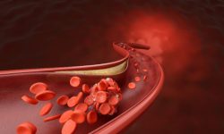 Un reciente artículo resume los tipos de predisposición genética a la enfermedad coronaria y su impacto en prevención, diagnóstico y tratamiento.