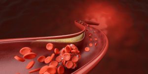 Un reciente artículo resume los tipos de predisposición genética a la enfermedad coronaria y su impacto en prevención, diagnóstico y tratamiento.