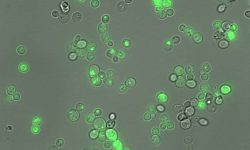 Una IA española descifra el lenguaje de la agregación de proteínas pegajosas.