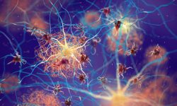 Una nueva estrategia terapéutica ha evaluado el potencial de las células CAR-T para atacar las placas de proteína beta amiloide en tejido nervioso que comprometen en funcionamiento de las neuronas y que caracterizan la enfermedad de Alzheimer