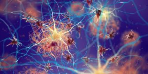 Una nueva estrategia terapéutica ha evaluado el potencial de las células CAR-T para atacar las placas de proteína beta amiloide en tejido nervioso que comprometen en funcionamiento de las neuronas y que caracterizan la enfermedad de Alzheimer