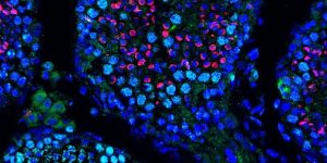 Una terapia basada en ARN mensajero recupera la producción de espermatozoides en ratones con infertilidad.