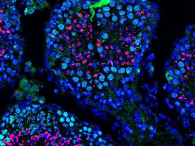 Una terapia basada en ARN mensajero recupera la producción de espermatozoides en ratones con infertilidad.