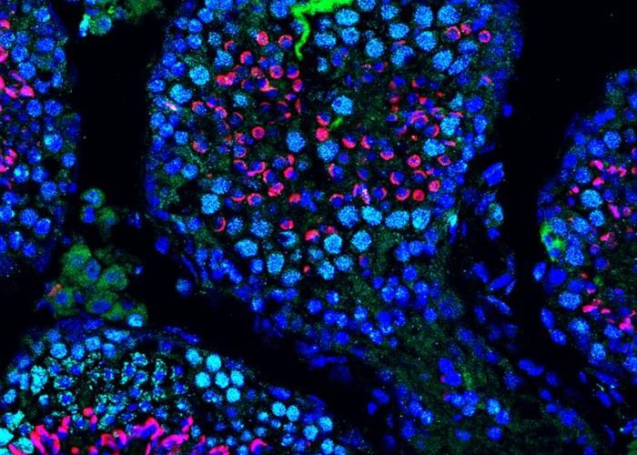 Una terapia basada en ARN mensajero recupera la producción de espermatozoides en ratones con infertilidad.