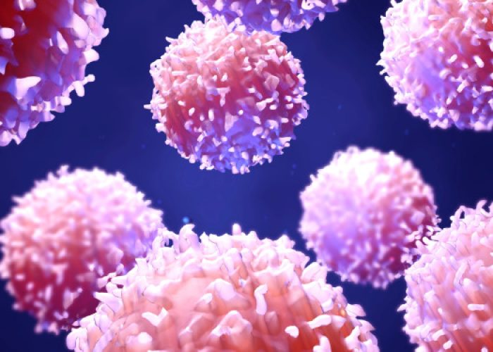 La vacuna terapéutica para el melanoma entrena al sistema inmunitario a reconocer y eliminar células tumorales específicas del paciente. Imagen: Adobe Express.