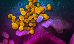 Imagen de partículas del virus SARS-CoV-2 emergiendo de una célula infectada. Imagen: National Institute of Allergy and Infectious Diseases.