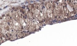 Macrófagos en placa aterosclerótica de ratón