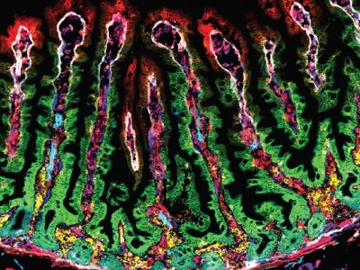 Imagen de tejido del intestino delgado humano obtenida para elaborar mapa de expresión.