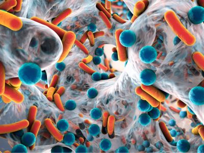 Bacterias presentes en los tumores cerebrales pueden influir en su desarrollo y respuesta a tratamiento.