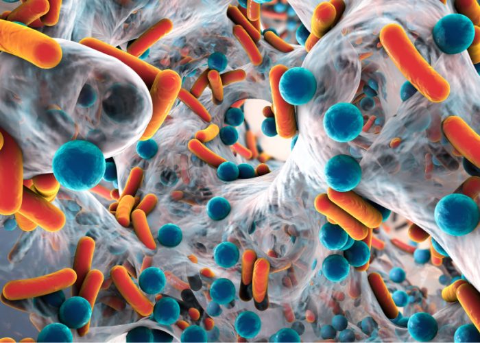 Bacterias presentes en los tumores cerebrales pueden influir en su desarrollo y respuesta a tratamiento.