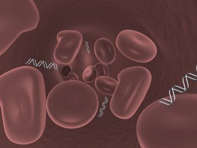 Las biopsias líquidas, que consisten en el análisis de ADN libre circulante en fluidos biológicos, han adquirido gran interés en el área de la oncología en los últimos años. Imagen: MedigenePress SL.
