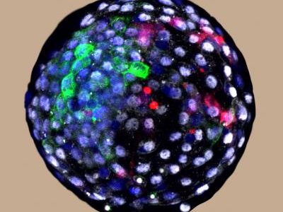 Uno de los embriones de ratón con células madre humanas incorporadas. Imagen: Weizhi Ji, Kunming University of Science and Technology.