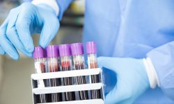 Los investigadores han analizado muestras de sangre de pacientes con DCL, EP, y EA en búsqueda de biomarcadores específicos que pudieran diferenciar estas tres enfermedades. Imagen: Ahmad Ardity, Pixabay.