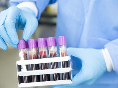 Los investigadores han analizado muestras de sangre de pacientes con DCL, EP, y EA en búsqueda de biomarcadores específicos que pudieran diferenciar estas tres enfermedades. Imagen: Ahmad Ardity, Pixabay.