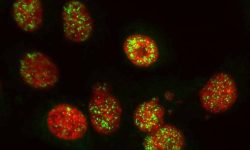 El bloqueo de la proteína PARP2 facilita la eliminación de las células tumorales y activar el sistema inmunitario frente al cáncer de páncreas.