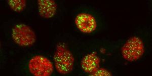El bloqueo de la proteína PARP2 facilita la eliminación de las células tumorales y activar el sistema inmunitario frente al cáncer de páncreas.