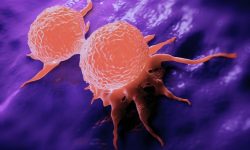 Pacientes supervivientes de cáncer con puntuaciones de riesgo poligénico más altas y mayor exposición a radiación tienen mayor incidencia de cánceres como el cáncer de mama. Imagen: Célula de cáncer de mama en división. Imagen: Getty Images vía Canva.
