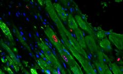 Cardiomiocitos proliferando tras la administración del gel que libera microARNs que promueven la regeneración del tejido cardiaco. Imagen: University of Pennsylvania.