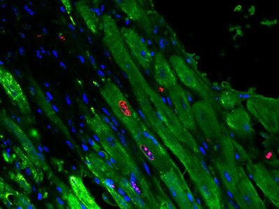Cardiomiocitos proliferando tras la administración del gel que libera microARNs que promueven la regeneración del tejido cardiaco. Imagen: University of Pennsylvania.