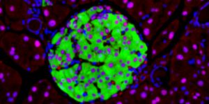 Imagen de células pancreáticas, en modelos de ratón. Un reciente estudio conecta la alteración del procesado del ARN en estas células con la diabetes tipo 2.