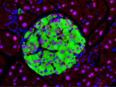 Imagen de células pancreáticas, en modelos de ratón. Un reciente estudio conecta la alteración del procesado del ARN en estas células con la diabetes tipo 2.