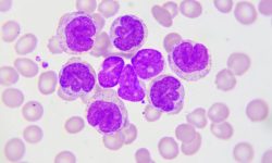 Células de leucemia. Imagen: Getty Images vía Canva.