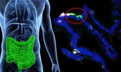 Células gastrointestinales de pacientes fueron modificadas para expresar insulina (mostrada en verde fluorescente). Imagen:  Columbia University Medical Center.