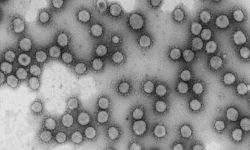 Virus de la familia coronaviridae. / Foto: Luis Enjuanes CNB-CSIC .