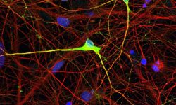 Las neuronas de un paciente con síndrome de Angelman carecen de expresión de proteína UBE3A debido a un defecto epigenético. En el nuevo estudio, los investigadores restauran la expresión normal de UBE3A en neuronas derivadas de pacientes, mediante la corrección del patrón de metilación. Imagen cortesía del Instituto Salk.