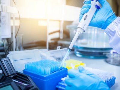 La Sociedad Europea de Oncología Médica recomienda limitar a siete los genes que deben incluirse en los paneles de análisis de mutaciones germinales en cáncer de mama.