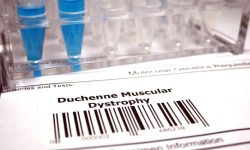La distrofia muscular de Duchenne es una enfermedad hereditaria caracterizada por la debilidad y degeneración muscular progresiva. Imagen: Getty Images, vía Canva.