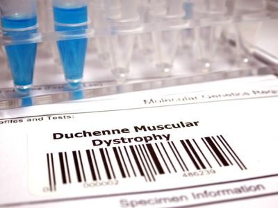 La distrofia muscular de Duchenne es una enfermedad hereditaria caracterizada por la debilidad y degeneración muscular progresiva. Imagen: Getty Images, vía Canva.