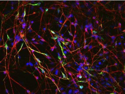 Neuronas diferenciadas a partir de células madre embrionarias. En verde, neuronas dopaminérgicas, principales células nerviosas afectadas en el Párkinson. Imagen: Xianmin Zeng lab, Buck Institute for Age Research, via CIRM