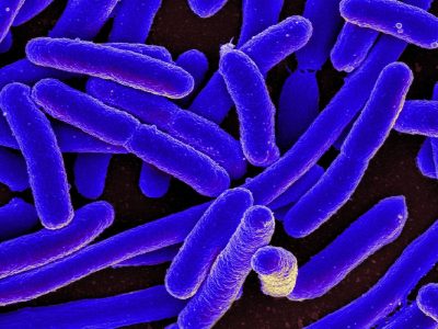 En nuestro intestino habitan millones de bacterias, que contribuyen a nuestro bienestar por medio de diferentes funciones relacionadas con la nutrición, el metabolismo y protección. Imagen: E. coli. National Institute of Allergy and Infectious Diseases (NIH).
