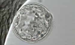 El diagnostico genético preimplantacional podría descartar embriones viables.