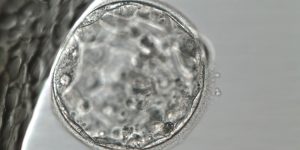 El diagnostico genético preimplantacional podría descartar embriones viables.