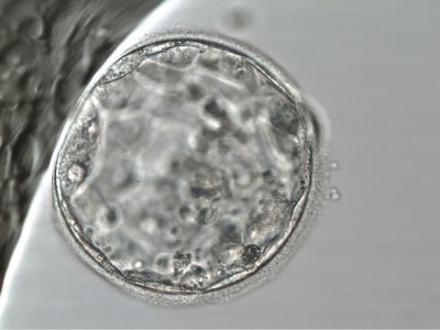 El diagnostico genético preimplantacional podría descartar embriones viables.