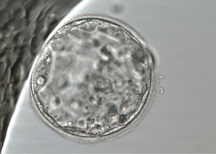 El diagnostico genético preimplantacional podría descartar embriones viables.